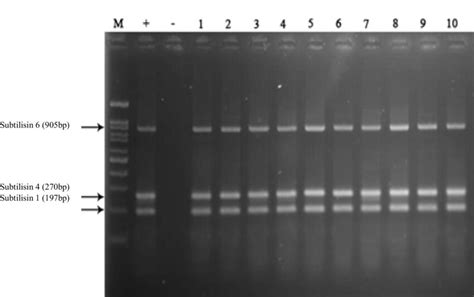 visualizing gel electrophoresis results|Gel electrophoresis (article) .